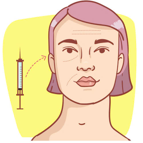 cay-mo-mat-gia-bao-nhieu-tim-hieu-chi-tiet-truoc-khi-quyet-dinh