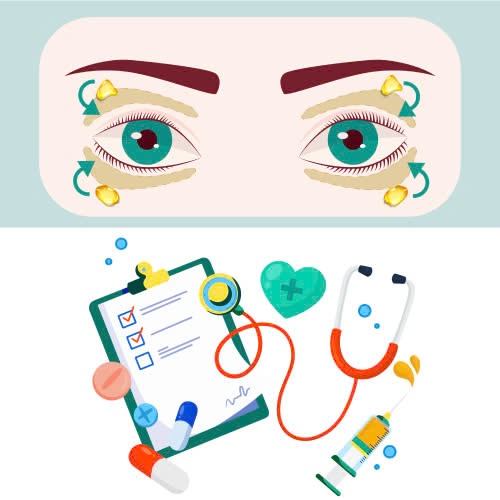 cay-mo-mat-gia-bao-nhieu-tim-hieu-chi-tiet-truoc-khi-quyet-dinh