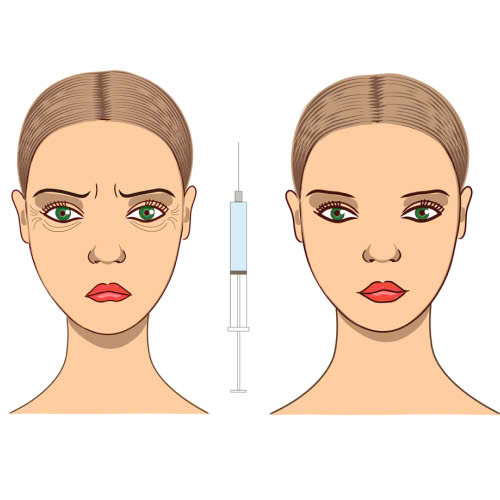 cay-mo-mat-hay-tiem-filler-tot-hon-so-sanh-chi-tiet-giup-ban-lua-chon-dung-giai-phap-phu-hop-voi-ban-than