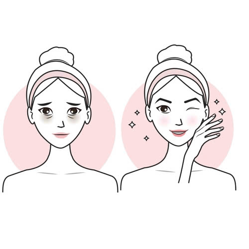 cay-mo-mat-la-gi-he-lo-bi-quyet-giup-doi-mat-tre-trung-day-suc-song-tu-nhien