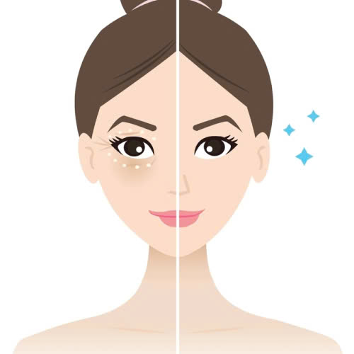 cay-mo-mat-la-gi-he-lo-bi-quyet-giup-doi-mat-tre-trung-day-suc-song-tu-nhien