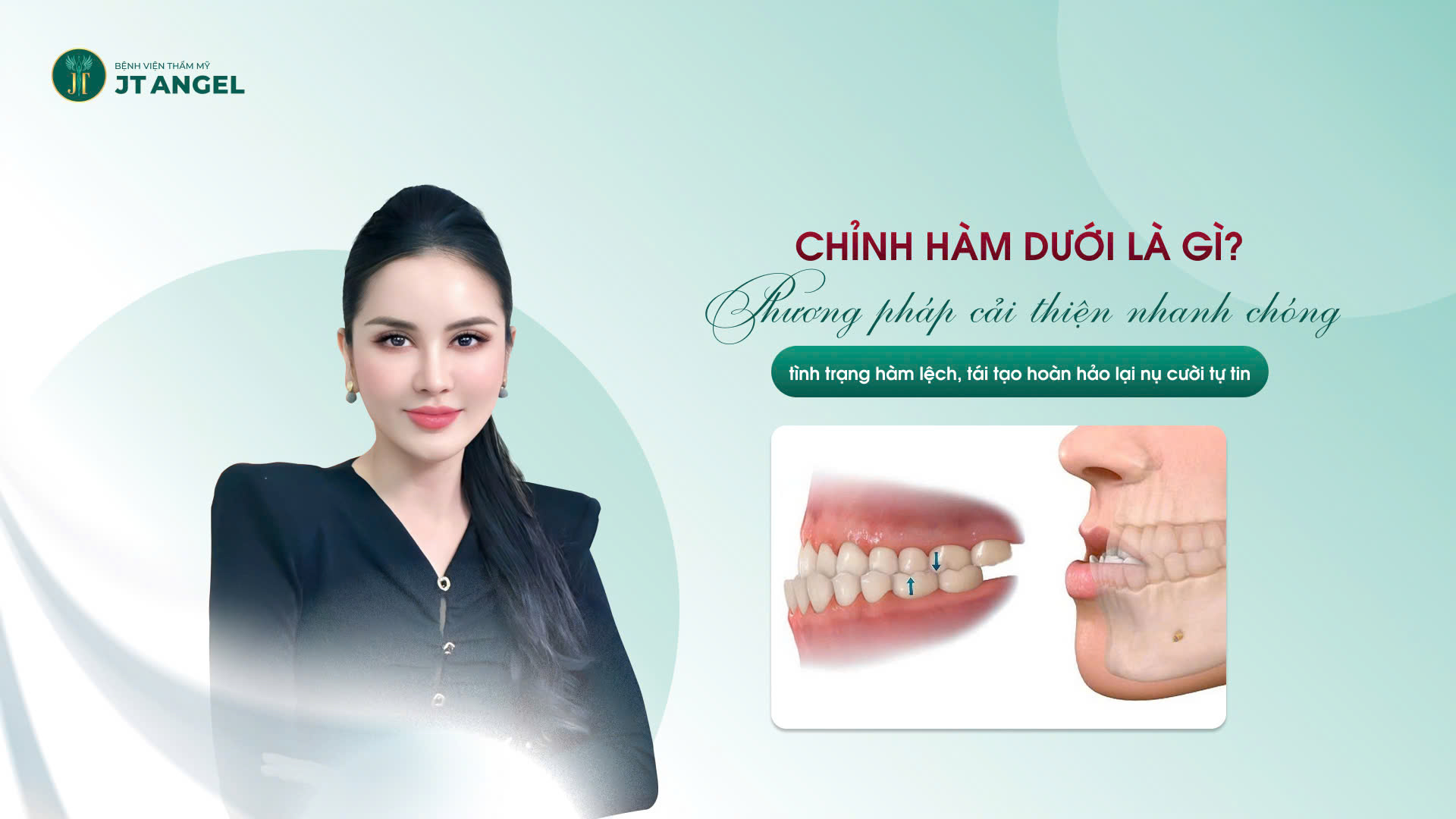 chinh-ham-duoi-la-gi-phuong-phap-cai-thien-nhanh-chong-tinh-trang-ham-lech-tai-tao-hoan-hao-lai-nu-cuoi-tu-tin