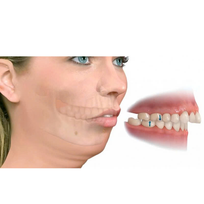 chinh-ham-tren-la-gi-dich-vu-khac-phuc-tinh-trang-ham-lech-tu-tin-voi-ve-dep-moi