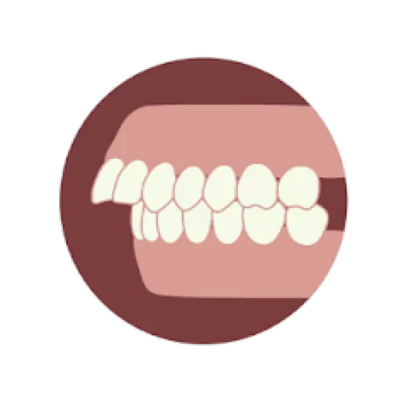 chinh-ham-tren-la-gi-dich-vu-khac-phuc-tinh-trang-ham-lech-tu-tin-voi-ve-dep-moi