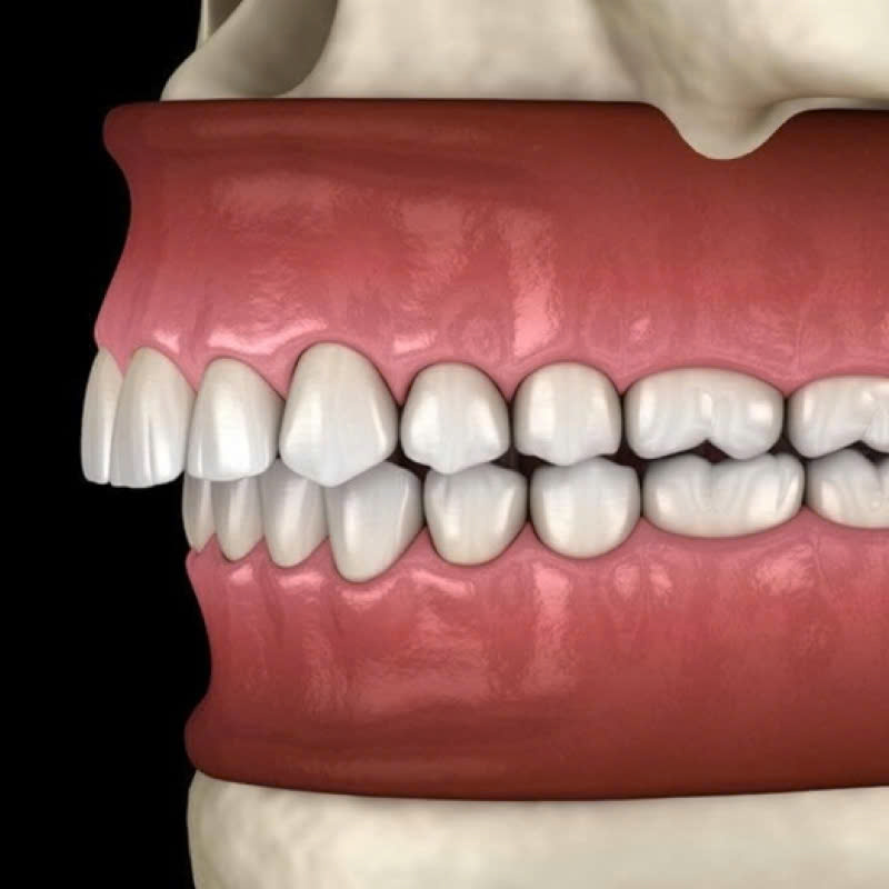 chinh-ham-tren-la-gi-dich-vu-khac-phuc-tinh-trang-ham-lech-tu-tin-voi-ve-dep-moi