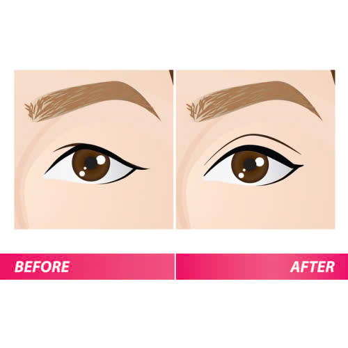 dia-chi-lay-mo-mi-tren-uy-tin-noi-tai-sinh-doi-mat-tuoi-tre-an-toan-va-tu-nhien