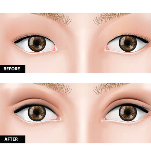 dia-chi-lay-mo-mi-tren-uy-tin-noi-tai-sinh-doi-mat-tuoi-tre-an-toan-va-tu-nhien