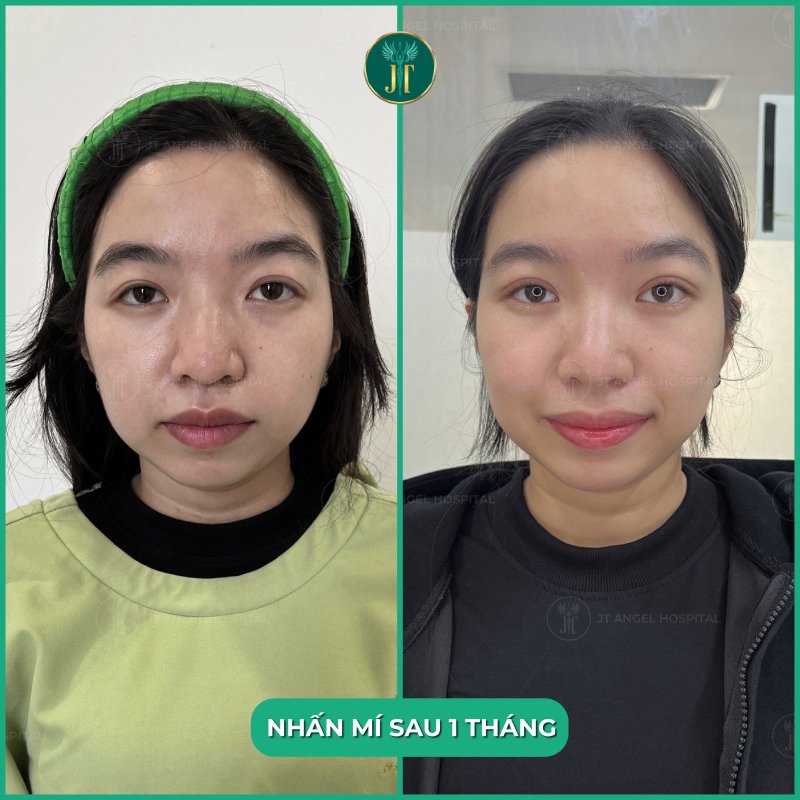 tim-hieu-dia-chi-nhan-mi-uy-tin-giup-ban-tranh-rui-ro-va-so-huu-doi-mat-tu-nhien-an-toan