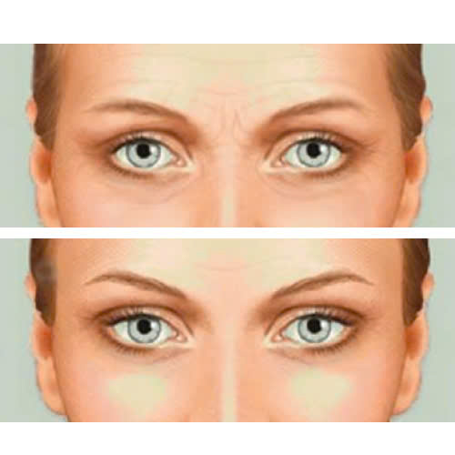 dau-la-dia-chi-xoa-nhan-duoi-mat-uy-tin-duoc-nhieu-chi-em-tin-chon-cung-tim-hieu-chi-tiet-trong-bai-viet-nay