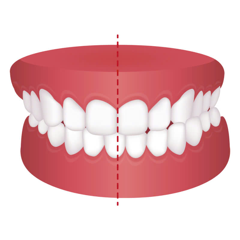 dieu-chinh-khop-can-giai-phap-cham-dut-con-dau-nhuc-va-cai-thien-nu-cuoi-hoan-hao