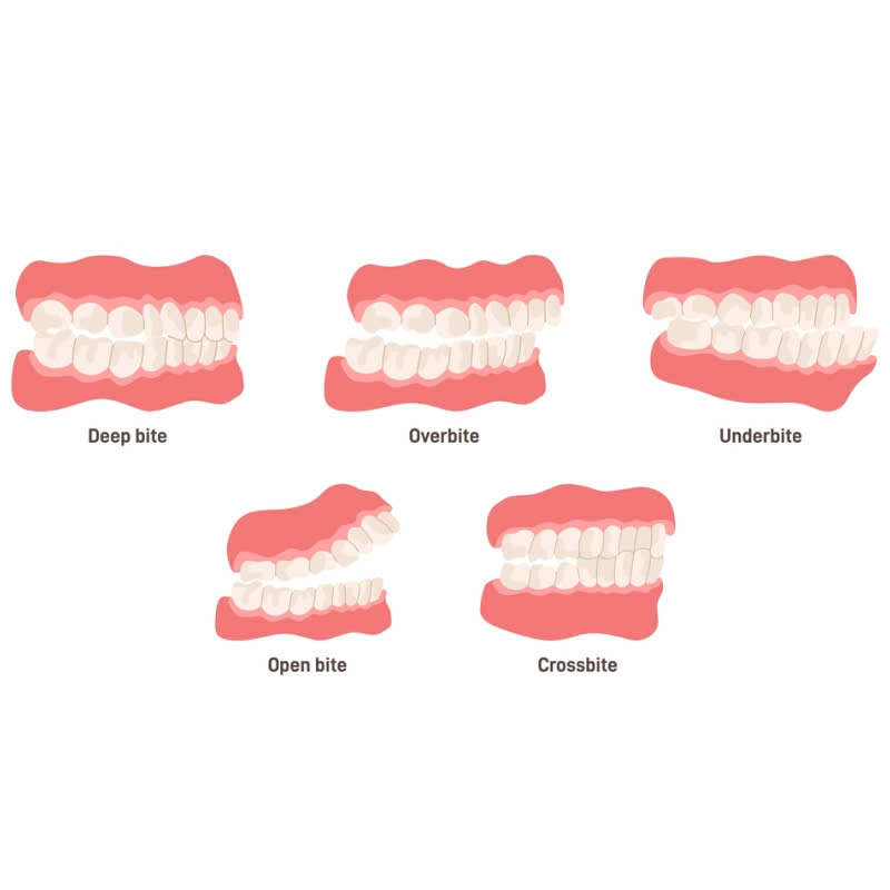 dieu-chinh-khop-can-giai-phap-cham-dut-con-dau-nhuc-va-cai-thien-nu-cuoi-hoan-hao