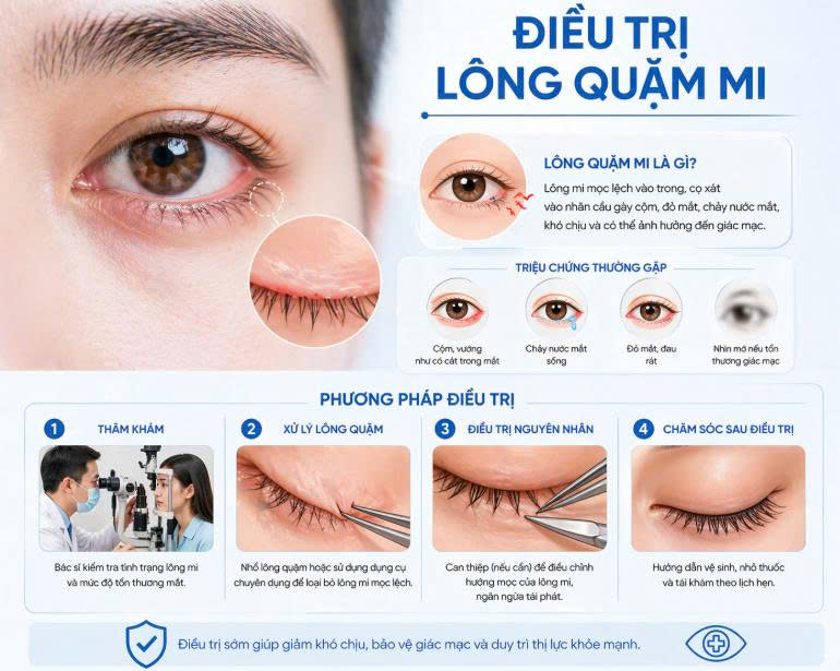 dieu-tri-long-quam-mi-bao-lau-thi-lanh-thoi-gian-hoi-phuc-chuan-va-cach-cham-soc-cho-nguoi-lan-dau-thuc-hien