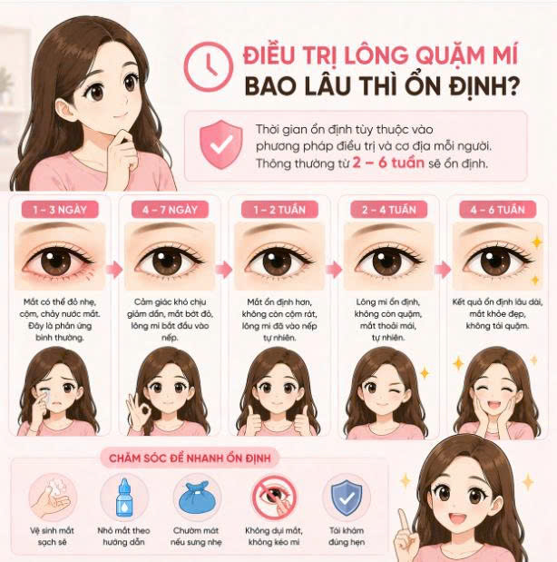 dieu-tri-long-quam-mi-bao-lau-thi-on-dinh-va-nhung-thong-tin-bo-ich-truoc-khi-thuc-hien