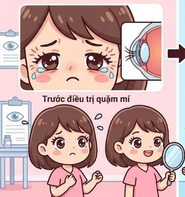 dieu-tri-long-quam-mi-co-de-lai-seo-khong-nhung-luu-y-quan-trong-va-loi-khuyen-giup-ban-dieu-tri-an-toan-hieu-qua