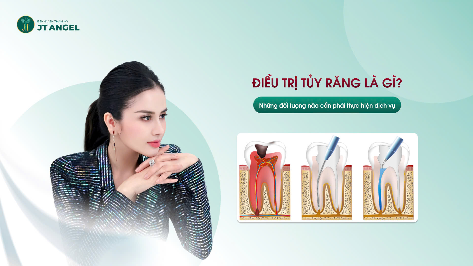 dieu-tri-tuy-rang-la-gi-nhung-doi-tuong-nao-can-phai-thuc-hien-dich-vu