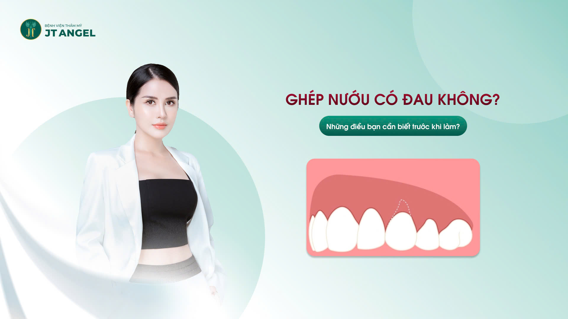 ghep-nuou-co-dau-khong-nhung-dieu-ban-can-biet-truoc-khi-lam