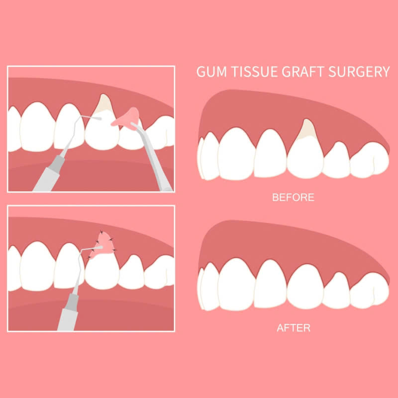 ghep-nuou-co-dau-khong-nhung-dieu-ban-can-biet-truoc-khi-lam