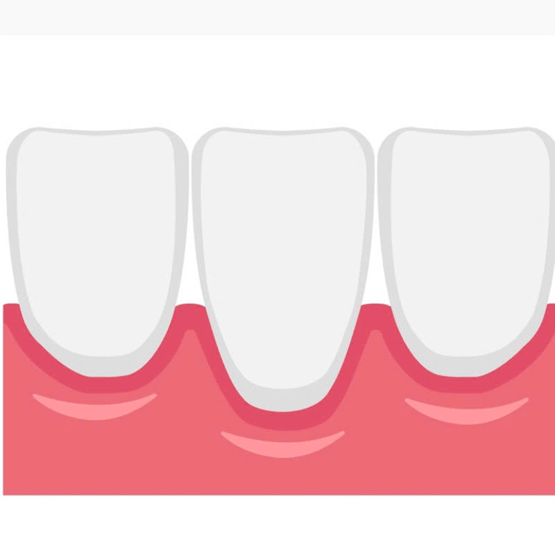 ghep-nuou-co-dau-khong-nhung-dieu-ban-can-biet-truoc-khi-lam