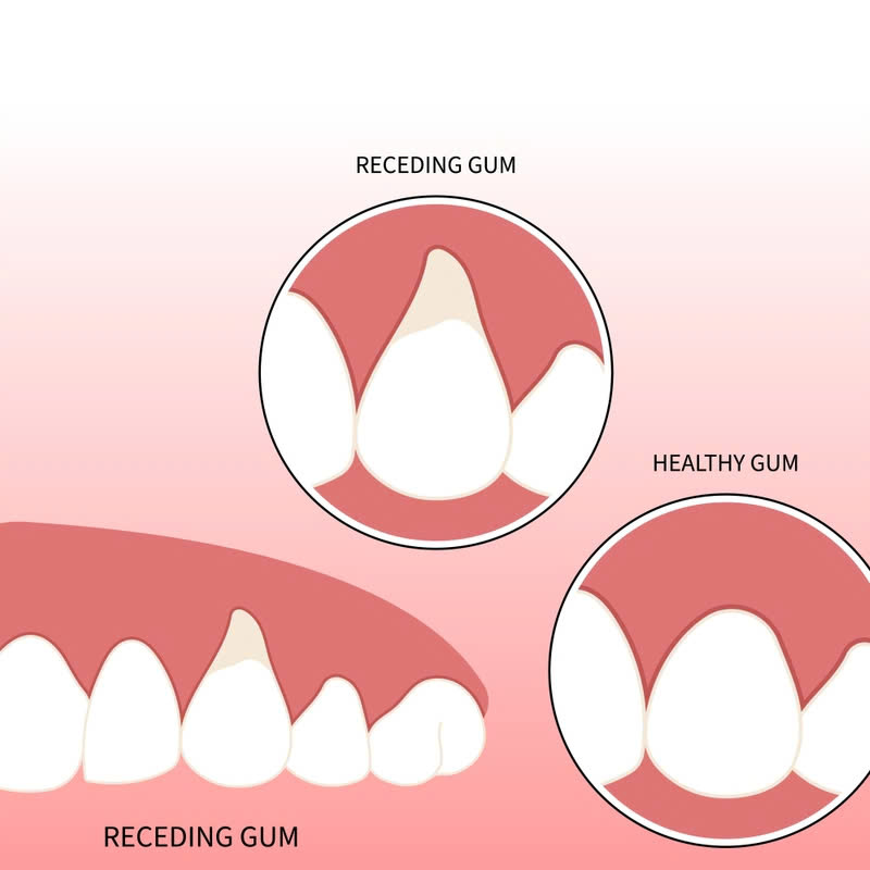 ghep-nuou-co-dau-khong-nhung-dieu-ban-can-biet-truoc-khi-lam