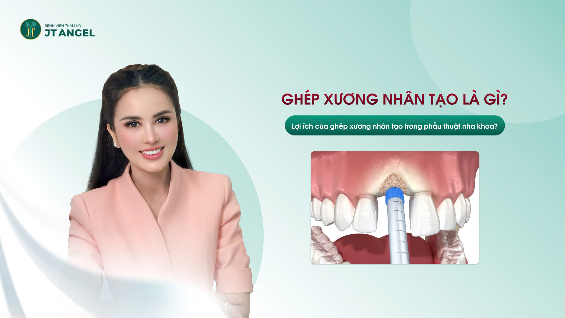 ghep-xuong-nhan-tao-la-gi-loi-ich-cua-ghep-xuong-nhan-tao-trong-phau-thuat-nha-khoa