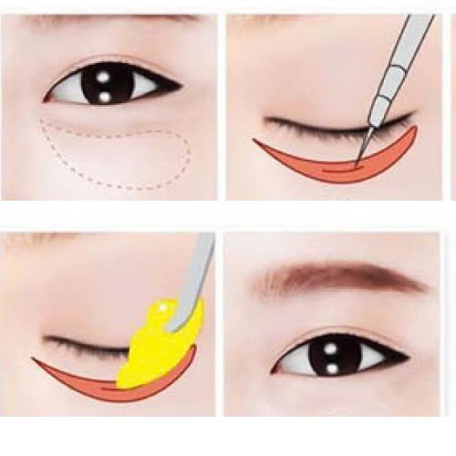 chiem-nguong-hinh-anh-truoc-sau-ha-bau-mat-minh-chung-ro-rang-cho-su-thay-doi-ngoan-muc