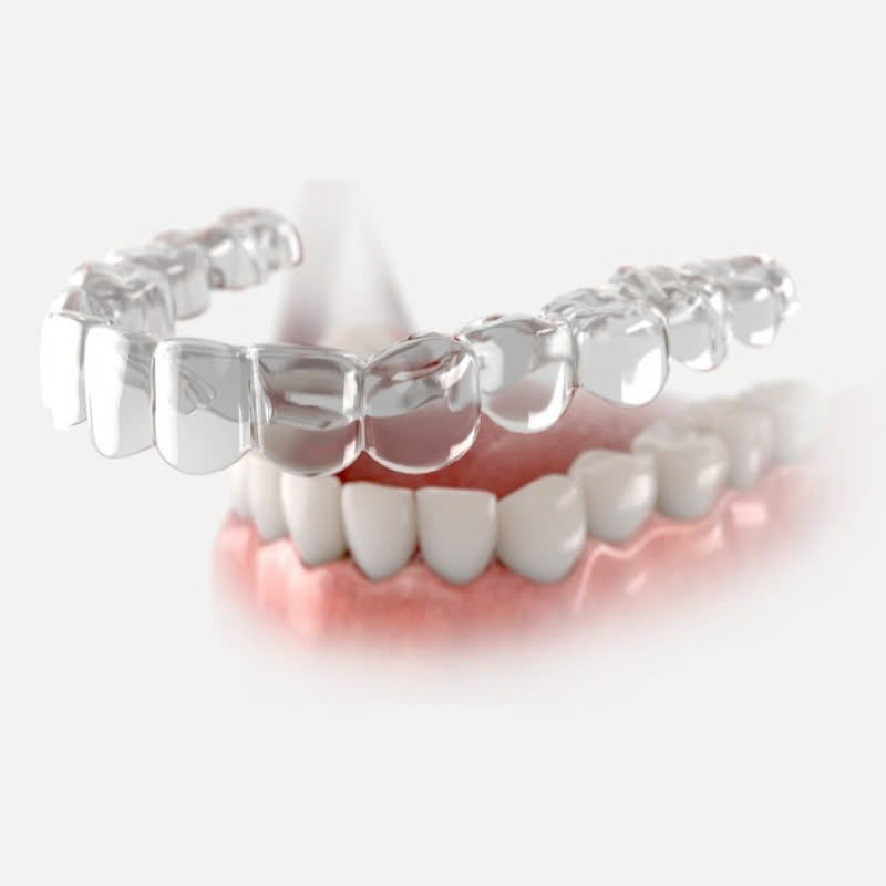 lam-ham-duy-tri-bi-quyet-de-giu-ham-rang-luon-deu-dep-sau-khi-nieng