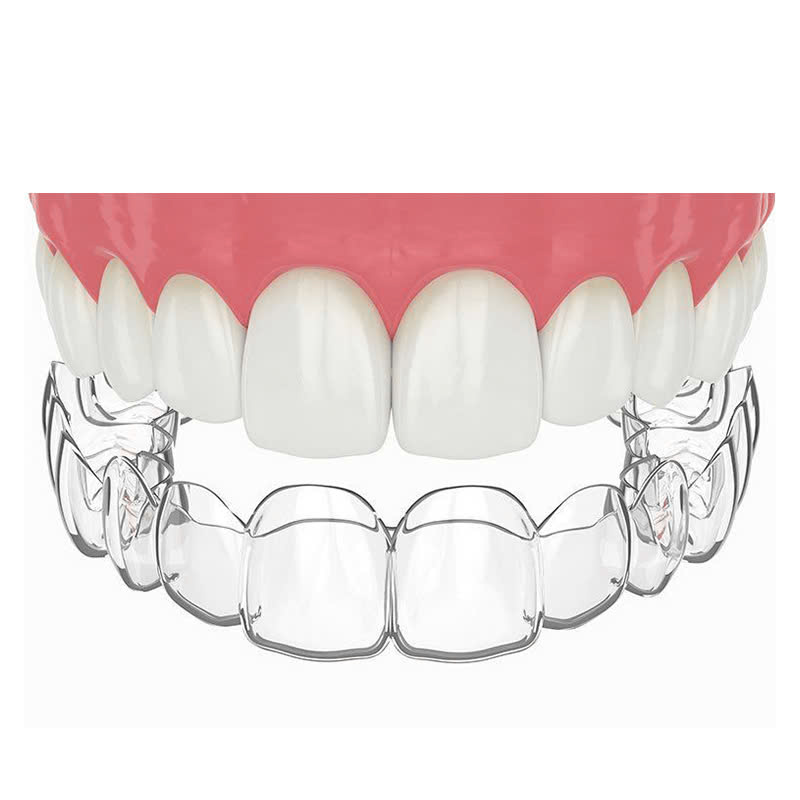 lam-ham-duy-tri-bi-quyet-de-giu-ham-rang-luon-deu-dep-sau-khi-nieng