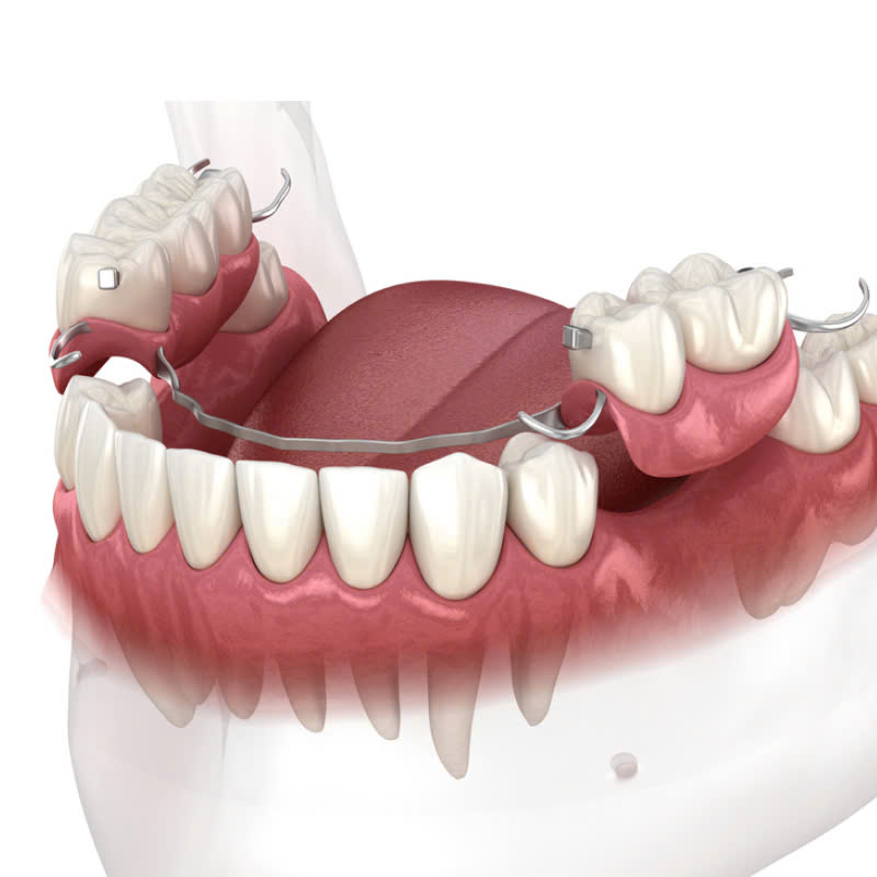 lam-ham-khung-titan-co-ben-khong-su-lua-chon-hoan-hao-cho-rang-gia-ben-nhe