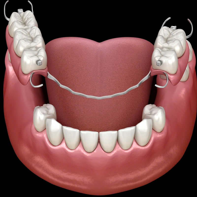 lam-ham-khung-titan-co-ben-khong-su-lua-chon-hoan-hao-cho-rang-gia-ben-nhe