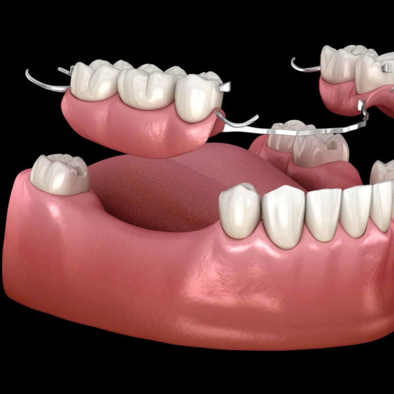 lam-ham-khung-titan-co-ben-khong-su-lua-chon-hoan-hao-cho-rang-gia-ben-nhe