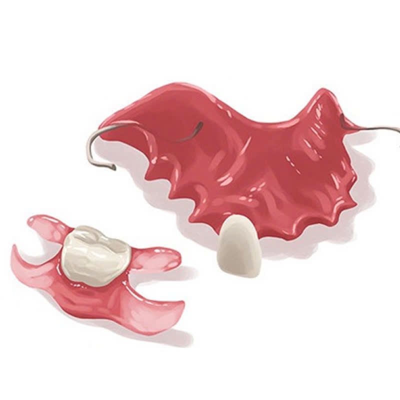 lam-rang-gia-thao-lap-gia-re-chat-luong-cao-giup-ban-tu-tin-trong-giao-tiep-va-phuc-hoi-chuc-nang-an-nhai