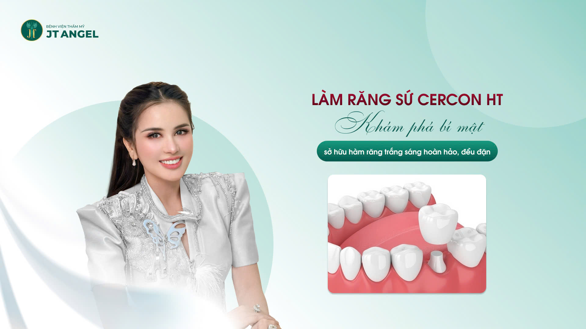 lam-rang-su-cercon-ht-kham-pha-bi-mat-so-huu-ham-rang-trang-sang-hoan-hao-deu-dan