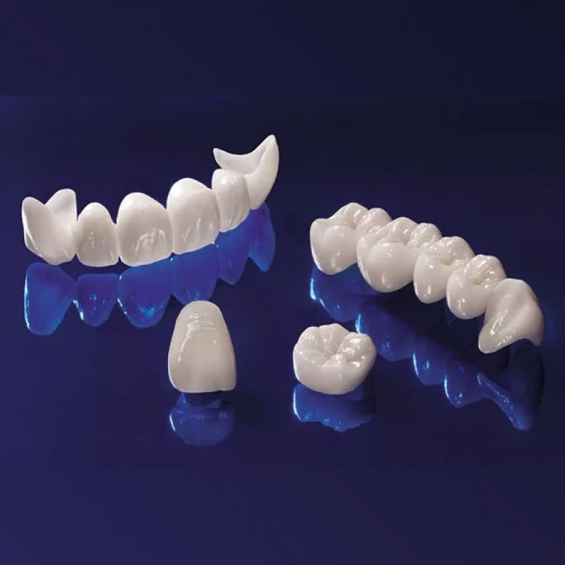 lam-rang-su-cercon-ht-kham-pha-bi-mat-so-huu-ham-rang-trang-sang-hoan-hao-deu-dan