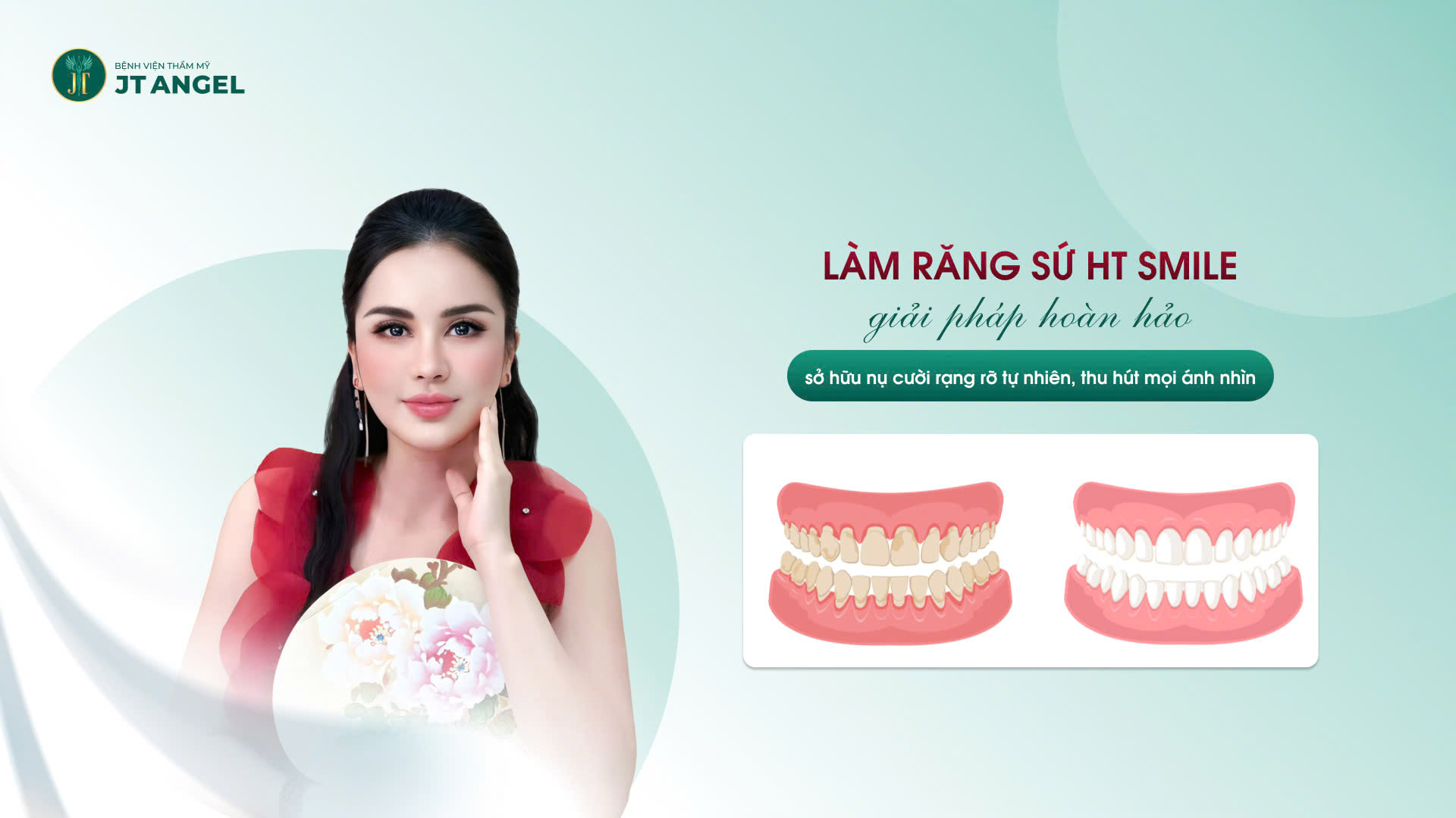 lam-rang-su-ht-smile-giai-phap-hoan-hao-so-huu-nu-cuoi-rang-ro-tu-nhien-thu-hut-moi-anh-nhin