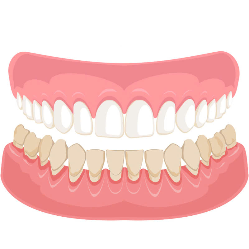 lam-rang-su-ht-smile-giai-phap-hoan-hao-so-huu-nu-cuoi-rang-ro-tu-nhien-thu-hut-moi-anh-nhin