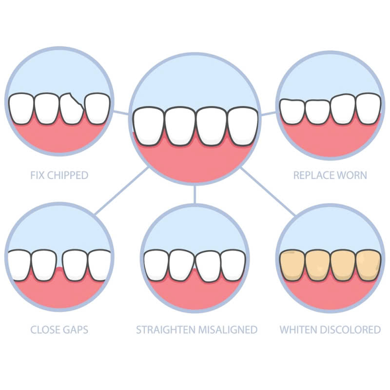 lam-rang-su-lisi-japan-lua-chon-ly-tuong-cho-nu-cuoi-hoan-hao-dep-tu-nhien-nhu-rang-that-va-kha-nang-chiu-luc-tot-thoai-mai-an-nhai