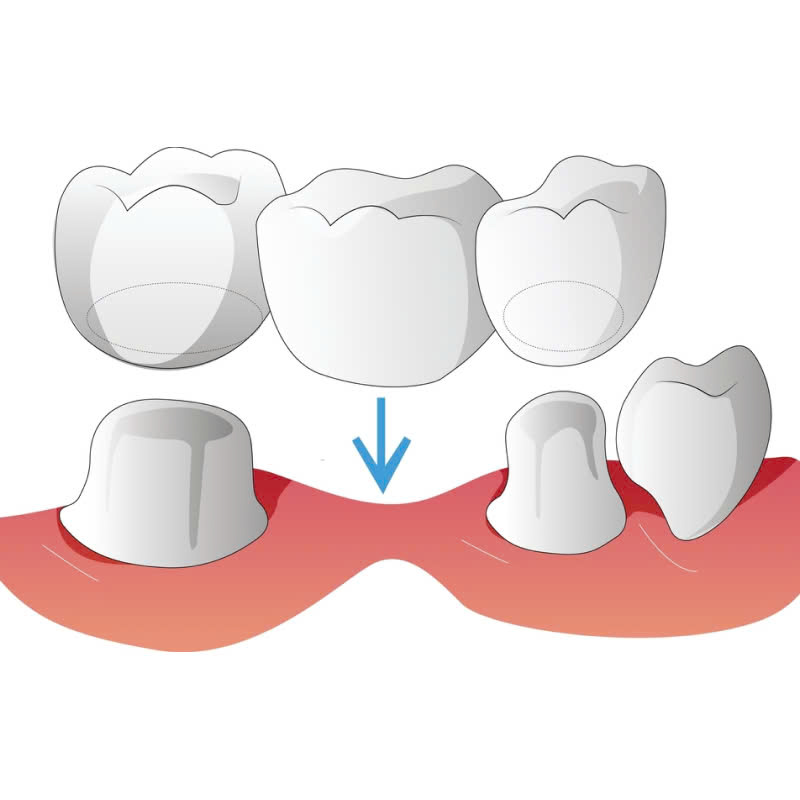 lam-rang-su-ngoc-trai-nacera-bat-mi-bi-quyet-so-huu-ham-rang-trang-sang-nhu-ngoc-trai