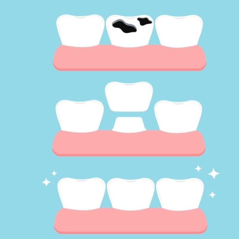 lam-rang-su-ngoc-trai-nacera-bat-mi-bi-quyet-so-huu-ham-rang-trang-sang-nhu-ngoc-trai