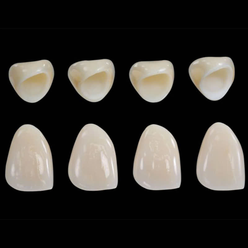 lam-rang-su-ngoc-trai-nacera-bat-mi-bi-quyet-so-huu-ham-rang-trang-sang-nhu-ngoc-trai