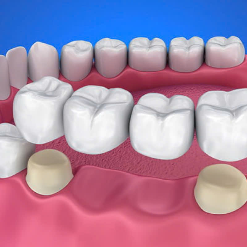 lam-rang-su-ngoc-trai-nacera-bat-mi-bi-quyet-so-huu-ham-rang-trang-sang-nhu-ngoc-trai