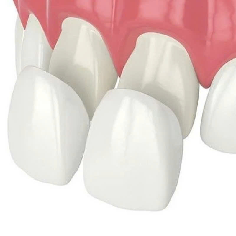 lam-rang-su-vision-cach-de-dang-va-nhanh-chong-giup-ban-so-huu-nu-cuoi-rang-ro