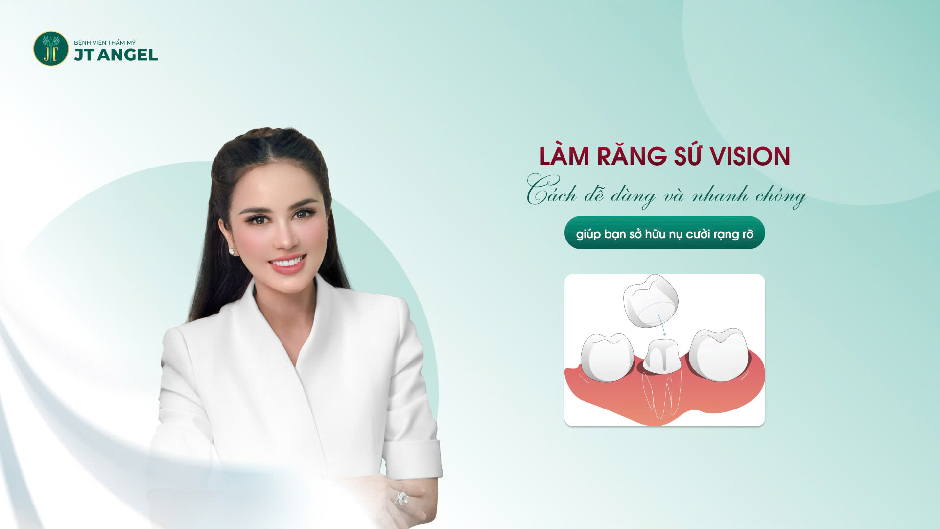 lam-rang-su-vision-cach-de-dang-va-nhanh-chong-giup-ban-so-huu-nu-cuoi-rang-ro