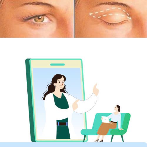 lay-mo-mi-tren-bao-lau-thi-lanh-mach-ban-cac-cach-cham-soc-giup-mi-mau-hoi-phuc-va-on-dinh