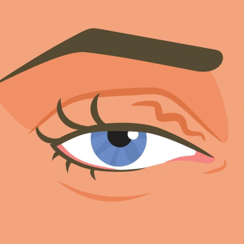 lay-mo-mi-tren-bi-hong-phai-lam-sao-dau-hieu-nhan-biet-nguyen-nhan-va-huong-xu-ly-an-toan-hien-nay