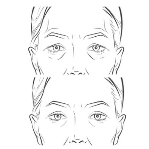 lay-mo-mi-tren-cho-nguoi-lon-tuoi-bi-quyet-giup-ban-niu-giu-thanh-xuan-va-tre-hoa-anh-nhin-tu-nhien-an-toan