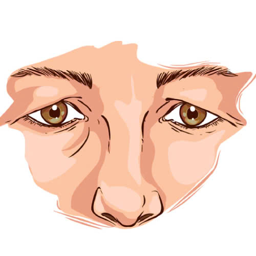 lay-mo-mi-tren-cho-nguoi-lon-tuoi-bi-quyet-giup-ban-niu-giu-thanh-xuan-va-tre-hoa-anh-nhin-tu-nhien-an-toan