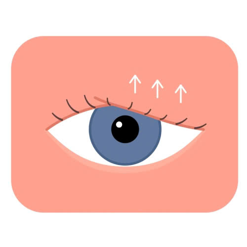 su-that-ve-lay-mo-mi-tren-co-dau-khong-goc-nhin-thuc-te-tu-khach-hang-da-trai-nghiem