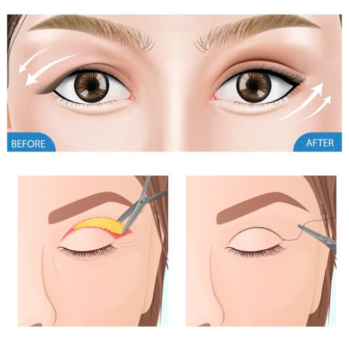 su-that-ve-lay-mo-mi-tren-co-dau-khong-goc-nhin-thuc-te-tu-khach-hang-da-trai-nghiem