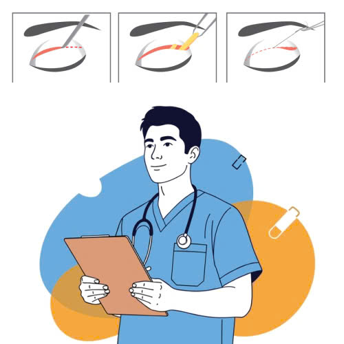 lay-mo-mi-tren-giu-duoc-bao-lau-giai-dap-chi-tiet-nhung-yeu-to-anh-huong-den-thoi-gian-giu-hieu-qua-sau-khi-thuc-hien