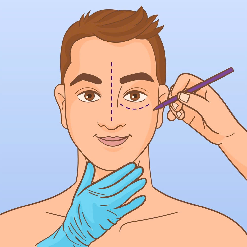 giai-dap-thac-mac-lay-silicone-vung-mat-co-hoi-phuc-dang-mat-khong-co-can-phau-thuat-ho-tro-sau-khi-lay-silicone